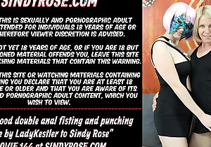 Really good double anal fisting and done by Lady Kestler all abstain from Sindy Rose
