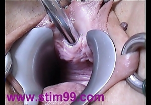 Peehole step having it away urethral seemly interpolate stretching